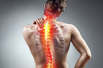 3D AI Posture Scanner